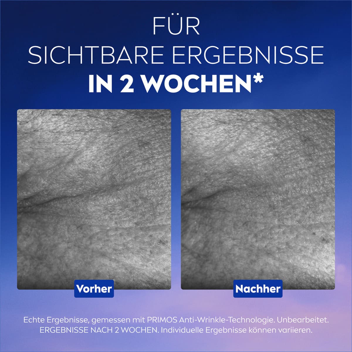 Produktbild NIVEA CELLULAR Epigenetics Verjüngendes Serum 9 von 11