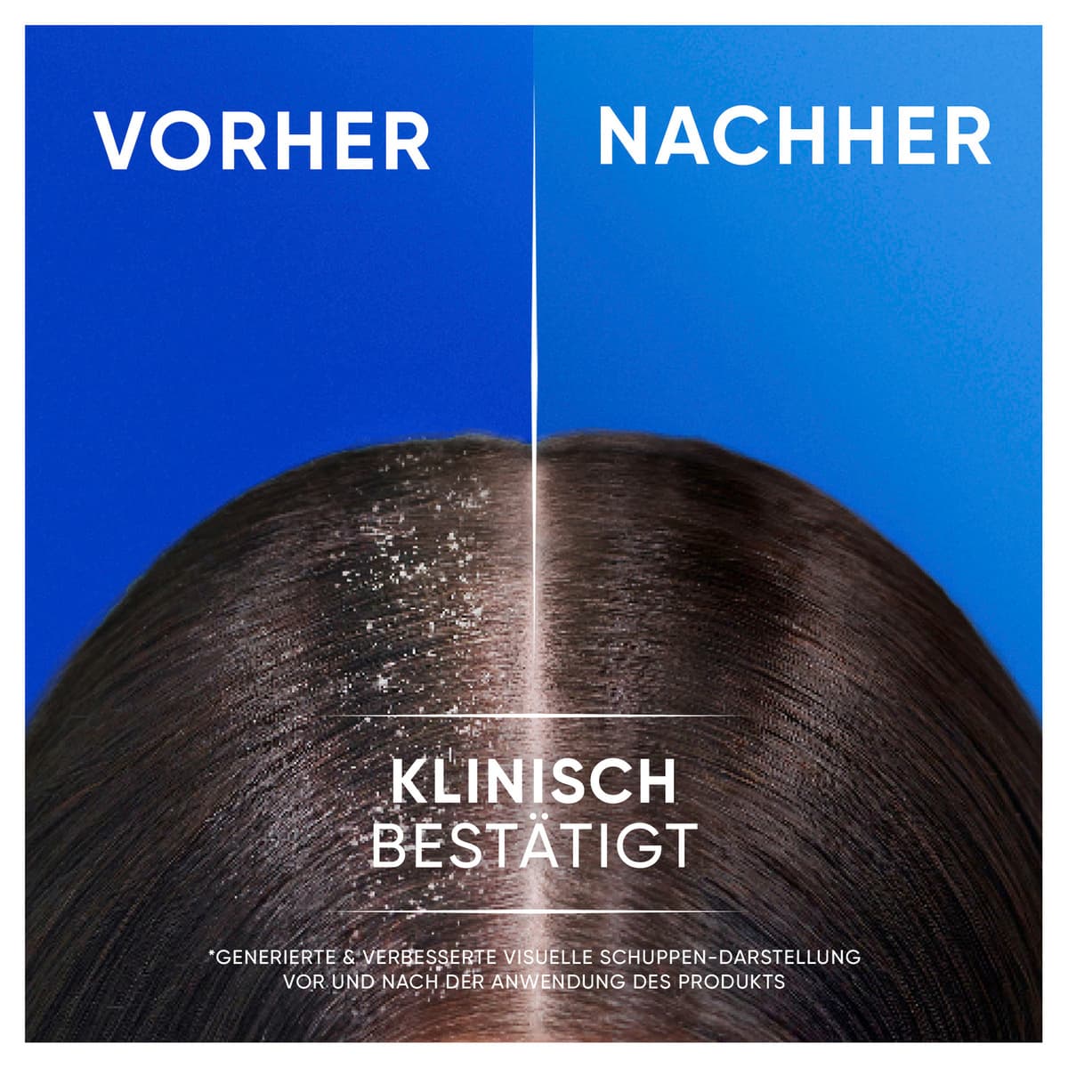 Produktbild Head & Shoulders Anti Schuppen Haarshampoo 2in1 citrus fresh  4 von 16