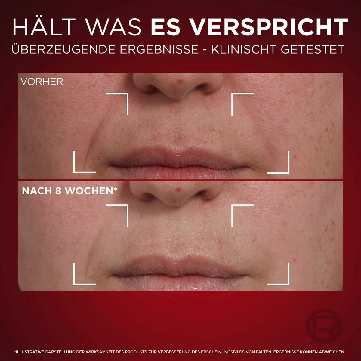 Produktbild L'Oréal Paris Revitalift Laser X3 Anti Age Intensivpflege Tagescreme 10 von 15
