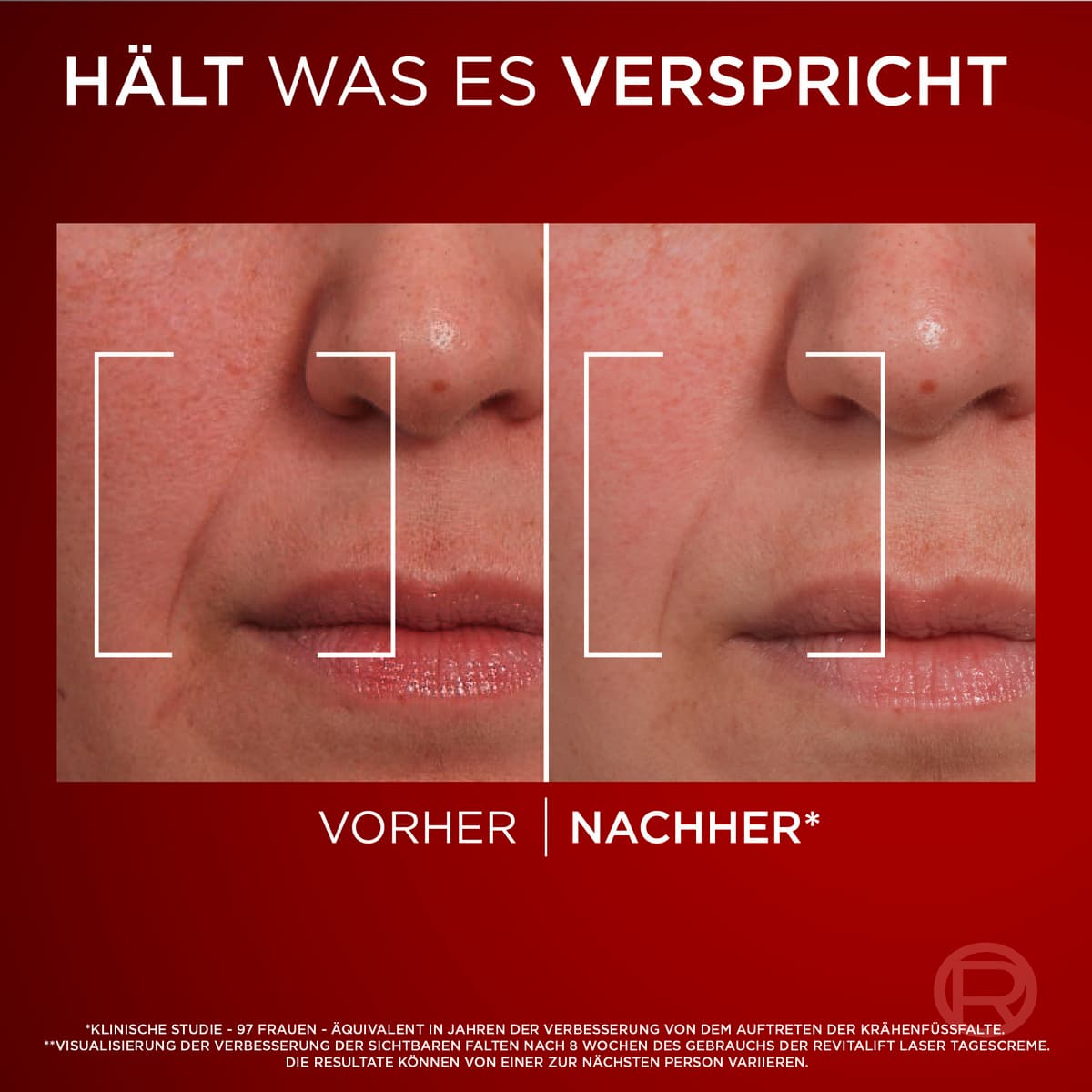 Produktbild L'Oréal Paris Revitalift Laser x3 Tagcreme+Nachtcreme Geschenkset 9 von 12