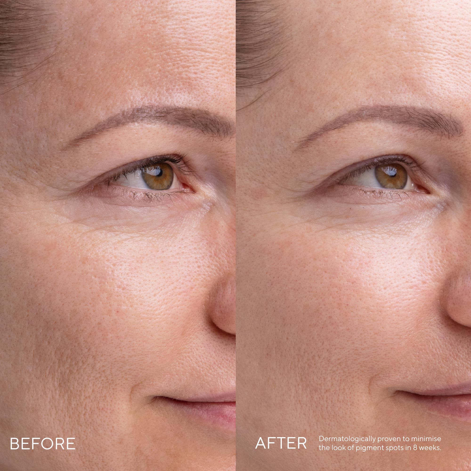 Produktbild MÁDARA KOJIC ALTERNATIVE Pigment Serum 7 von 8