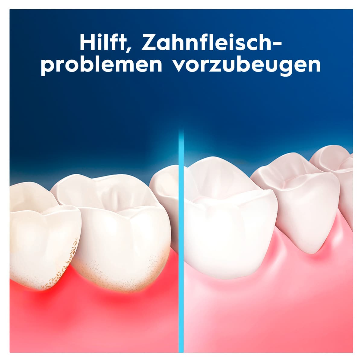 Produktbild Oral-B Zahnseide Pro Expert Advanced Tiefenreinigung frische Minze gewachst  5 von 9