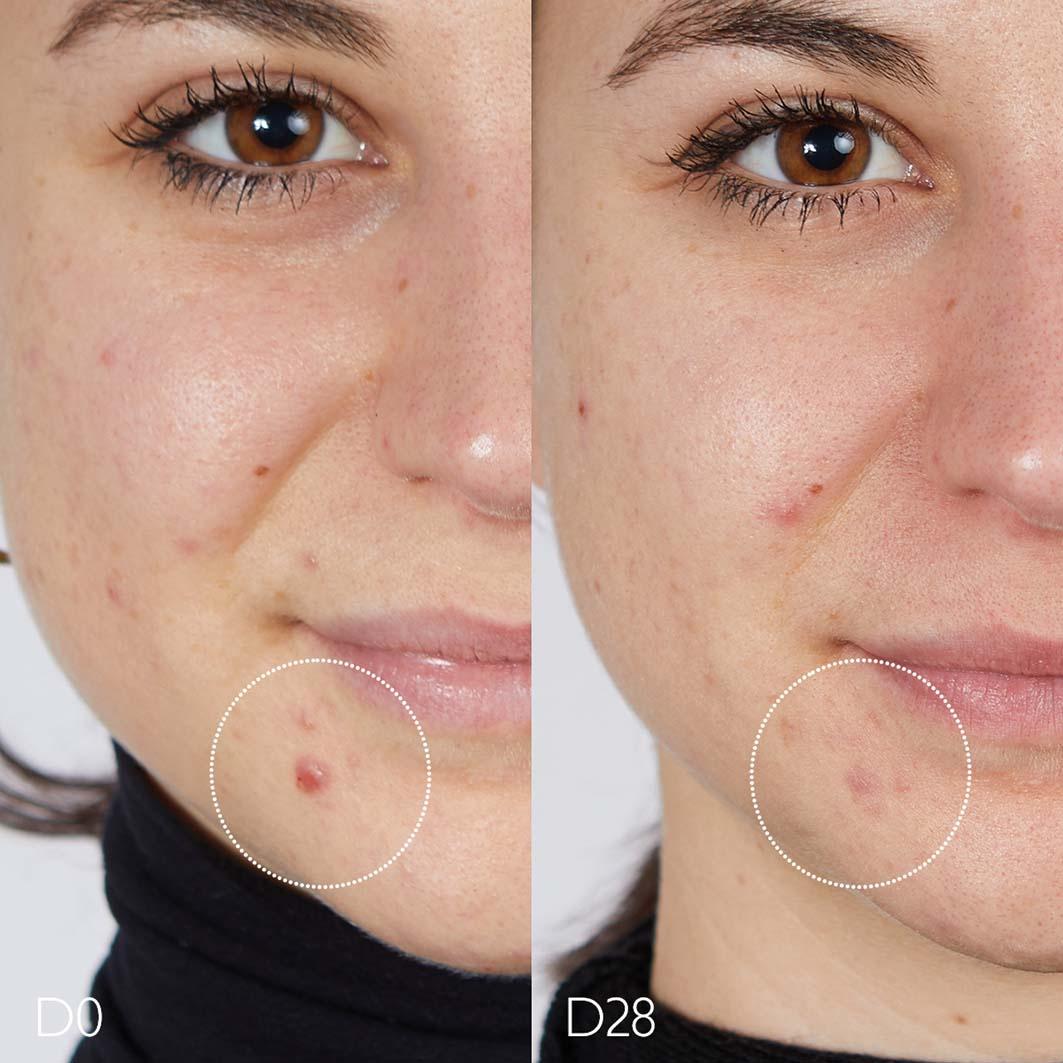 Produktbild CAUDALIE Vinopure Serum gegen Unreinheiten 4 von 6