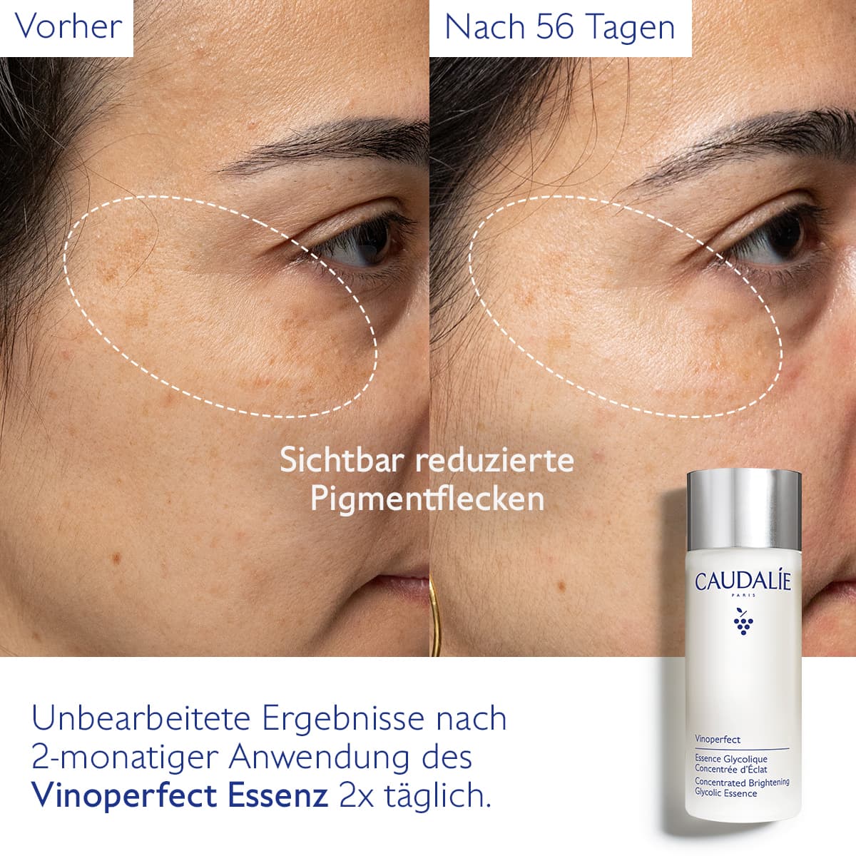 Produktbild CAUDALIE Vinoperfect Concentrated Brightening Glycolic Essence 4 von 6