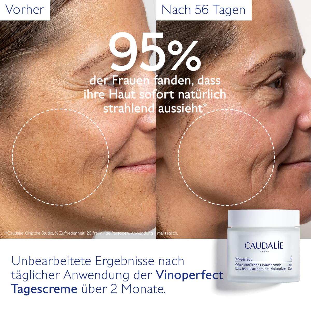 Produktbild CAUDALIE Vinoperfect Anti-Pigmentflecken Creme Niacinamid Nachfüllbar 4 von 6