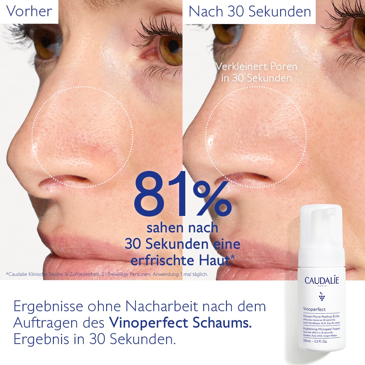 Produktbild CAUDALIE Vinoperfect Mikro-Peeling Schaum 3 von 5