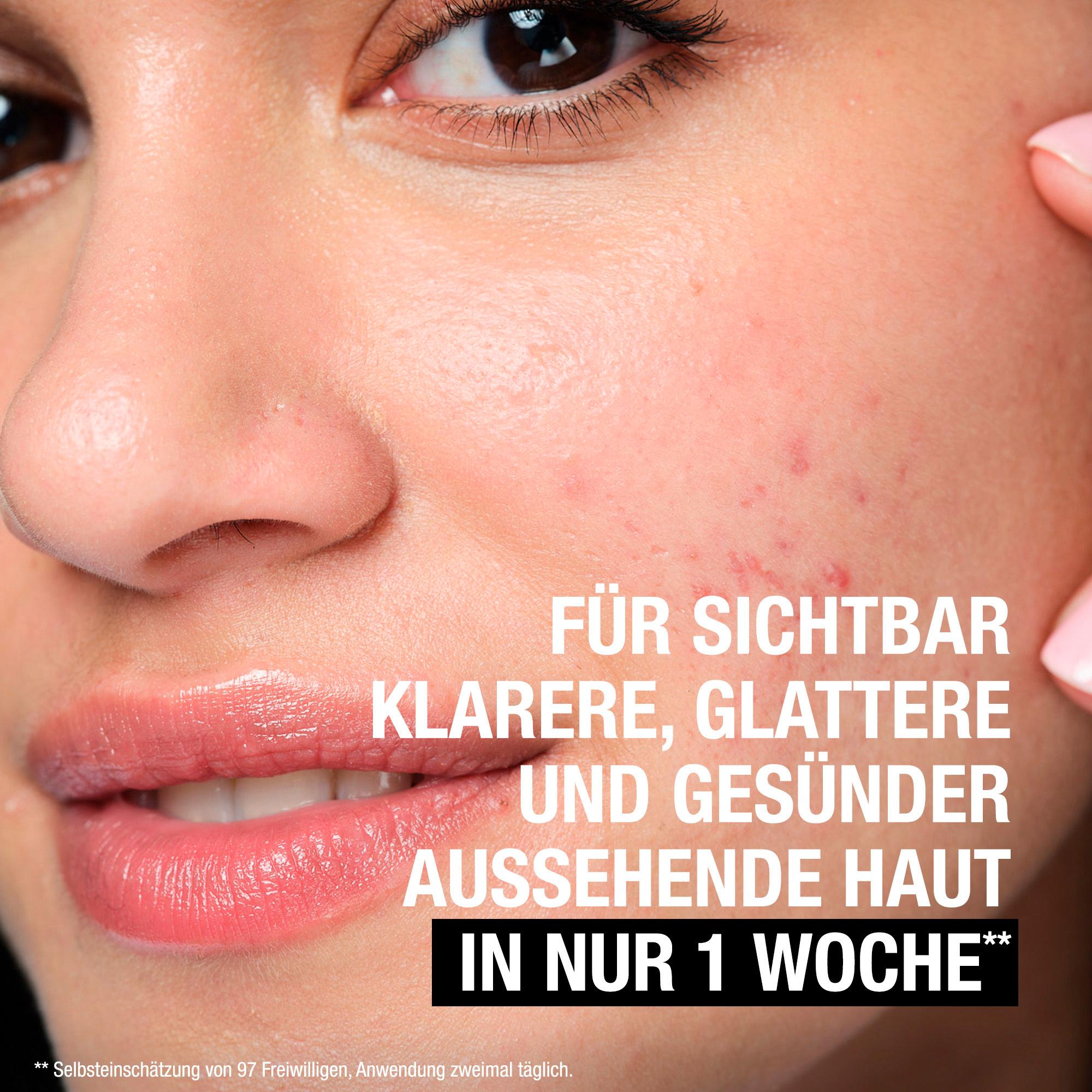 Produktbild Neutrogena Peeling Cleanser Anti-Pickel+ 12 von 12