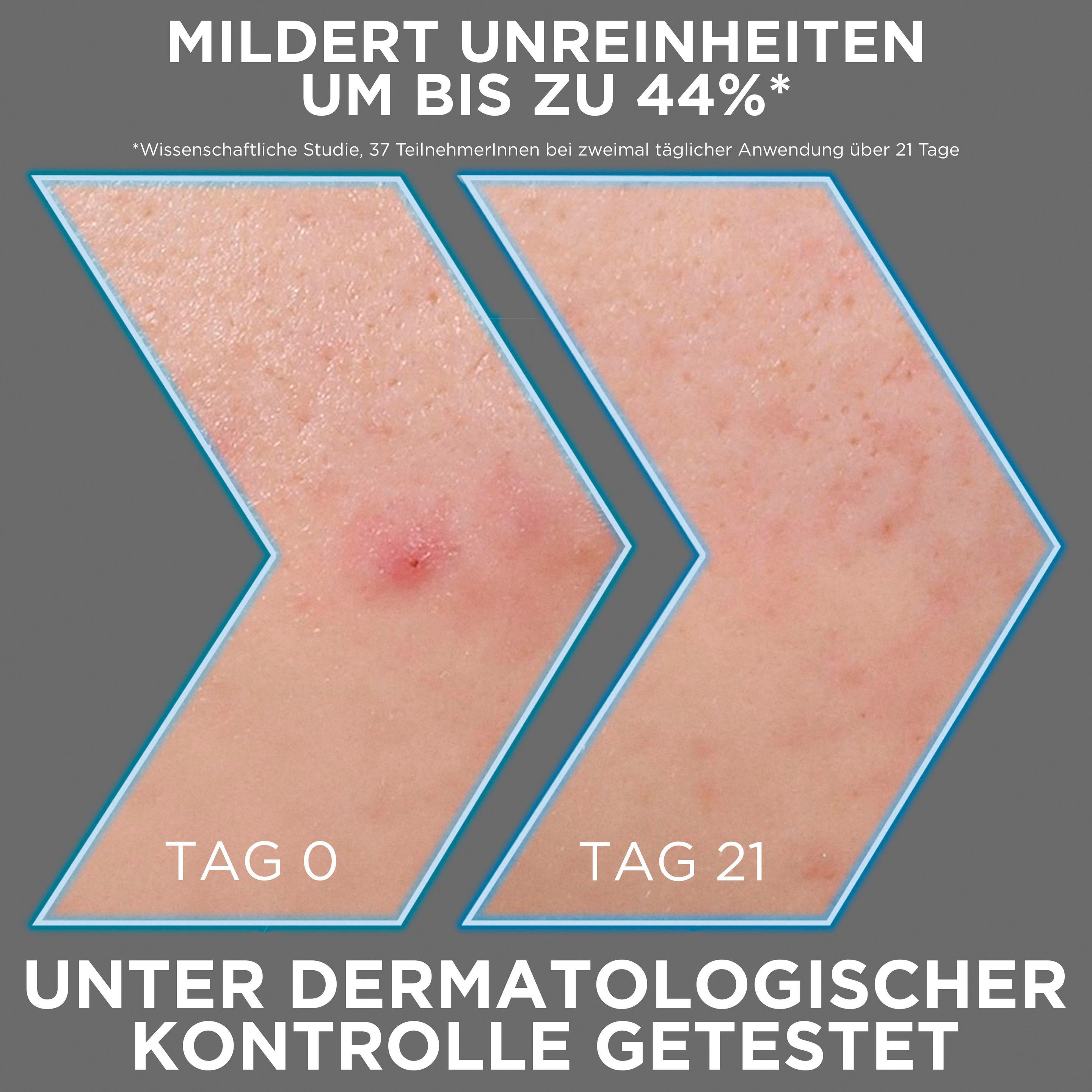 Produktbild Garnier Hautklar Pure Anti-Akne Serum Blemish Blackout 7 von 8