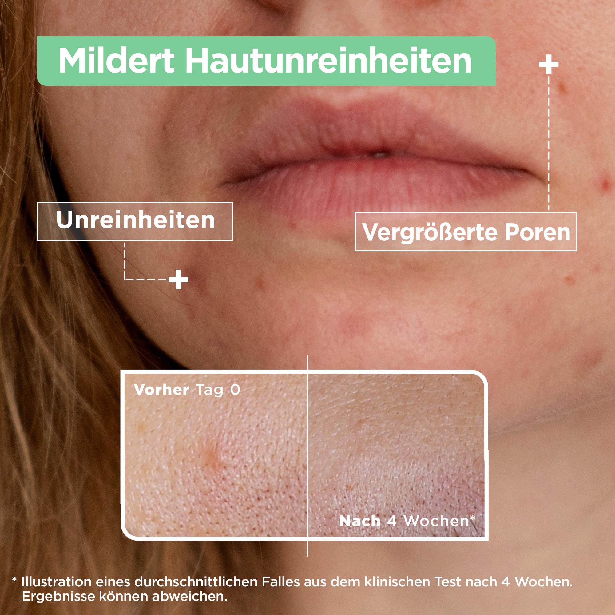 Produktbild Mixa Anti-Unreinheiten Serum mit Salicylsäure + Niacinamid 13 von 13