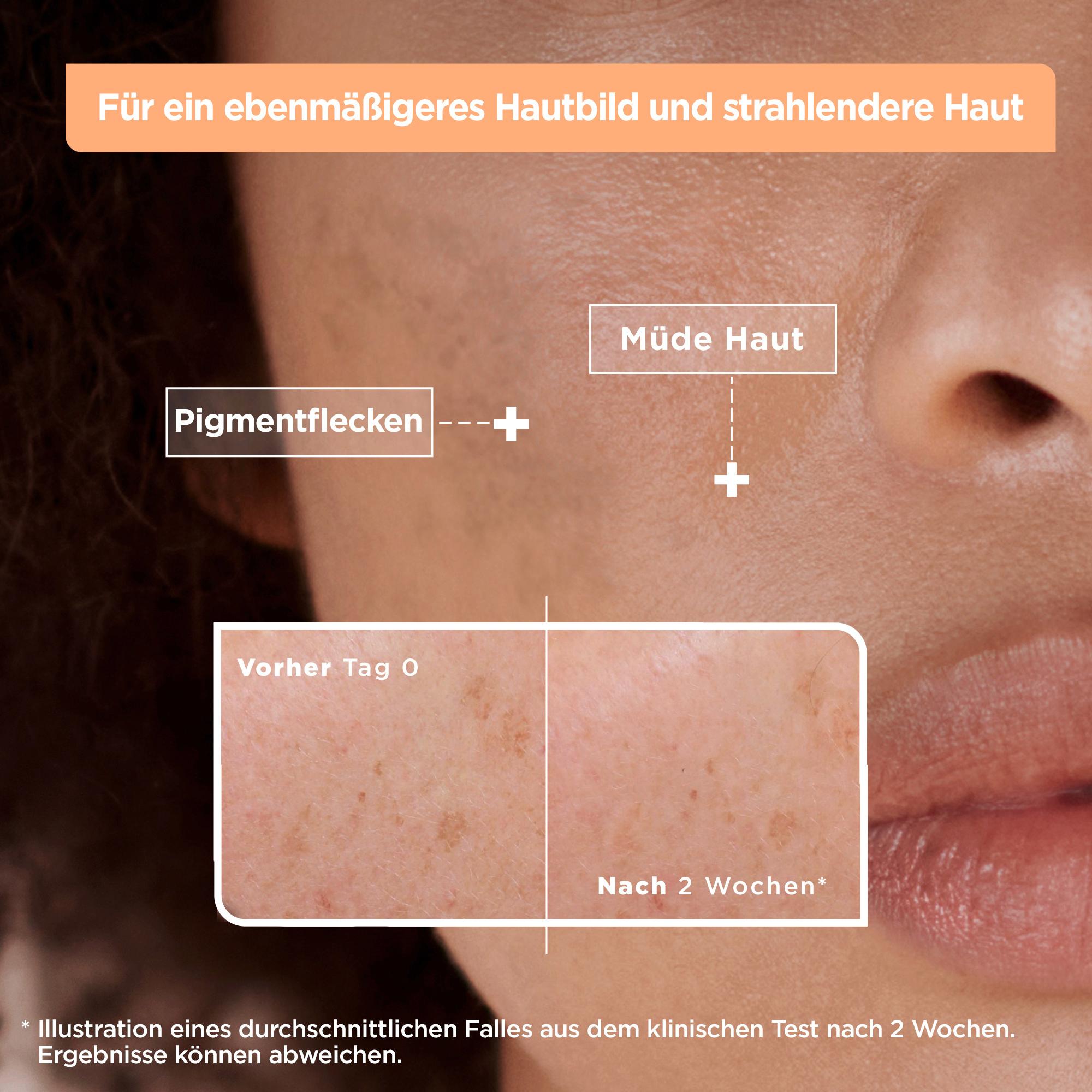 Produktbild Mixa Anti-Pigmentflecken Serum mit Vitamin  C + Glykolsäure 6 von 13