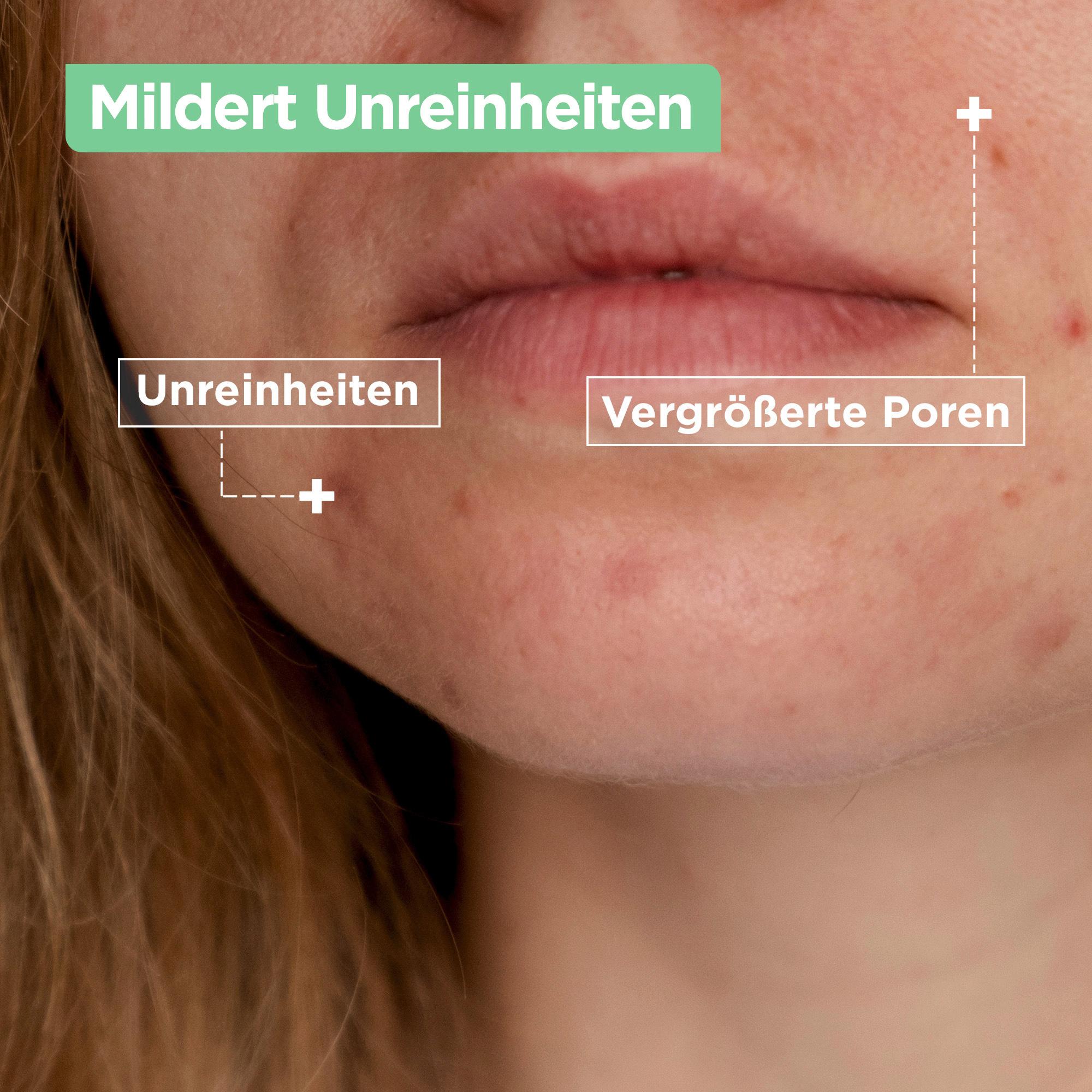 Produktbild Mixa Anti-Unreinheiten Cleanser Salicylsäure + Squalan 3 von 10