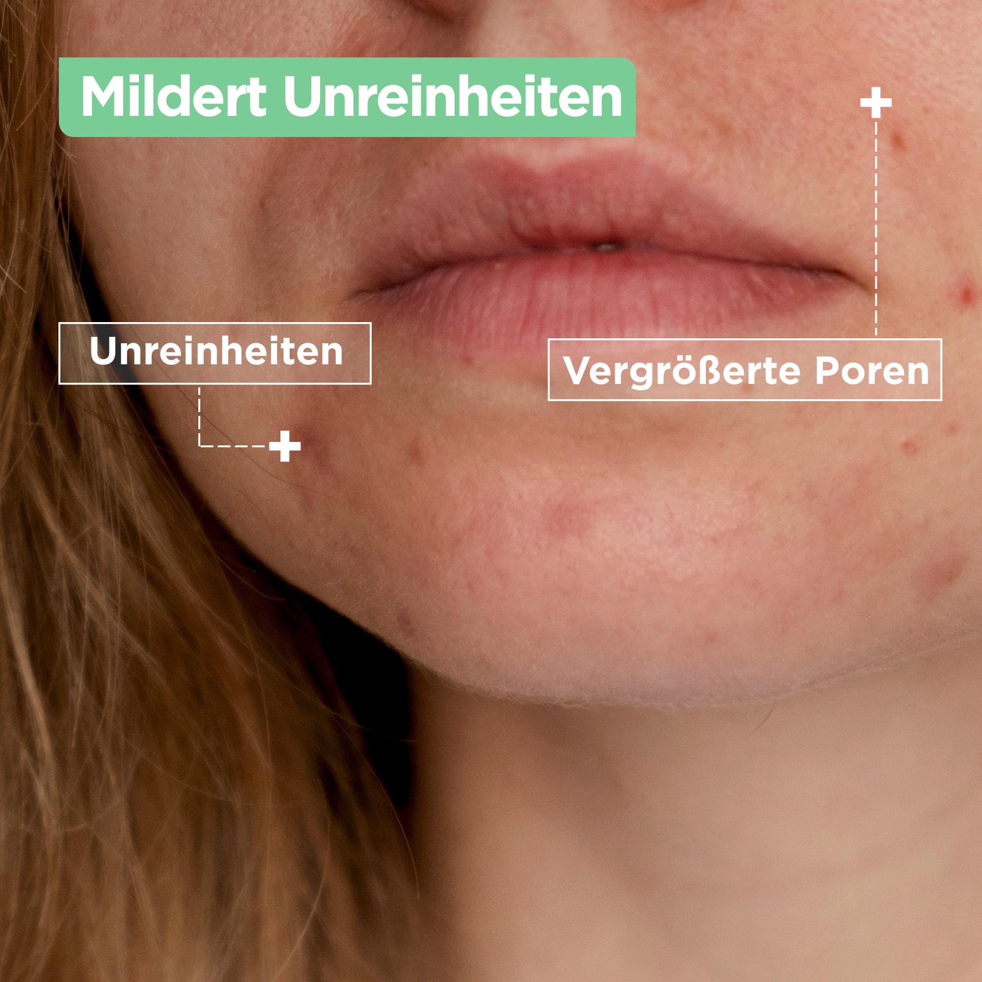 Produktbild Mixa Anti-Unreinheiten Mattierende Gel-Creme mit Salicylsäure + AHA 4 von 12
