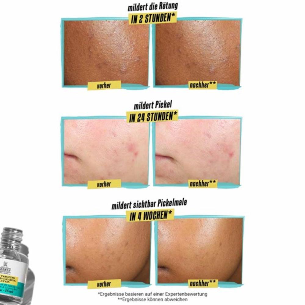 Produktbild KIEHL'S Truly Targeted Blemish Clearing Solution 4 von 7