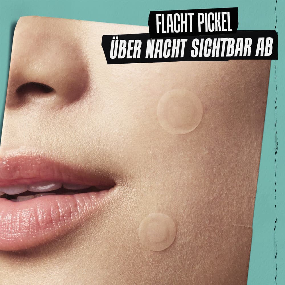 KIEHL'S Truly Targeted Overnight Blemish Patches