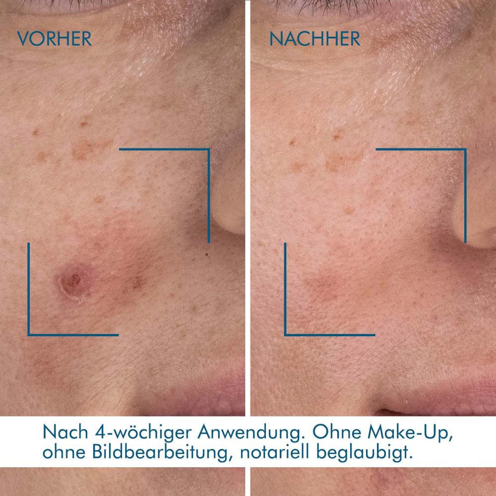 Produktbild BIOTHERM Serum Blue Retinol Resurface & Repair  Night 3 von 5