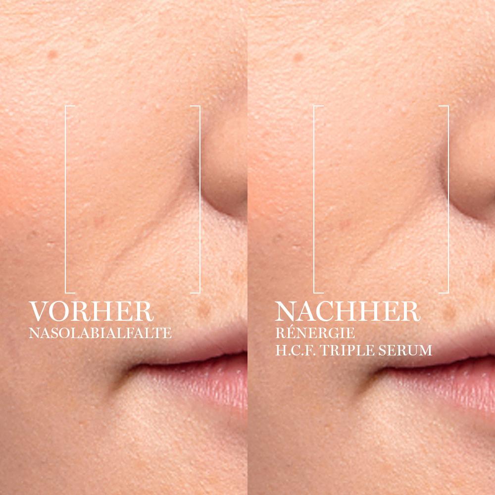 Produktbild LANCÔME Rénergie H.C.F. Triple Serum 3 von 6