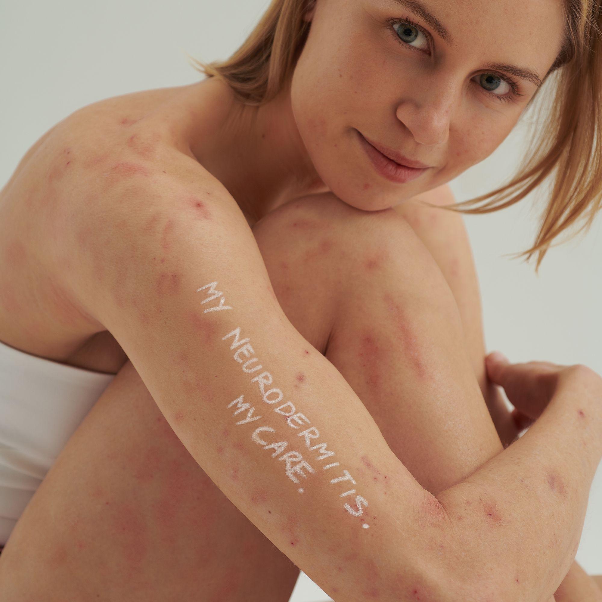 Produktbild DADO SENS EXTRODERM Reinigungscreme- bei  trockener Haut und Neurodermitis 3 von 6