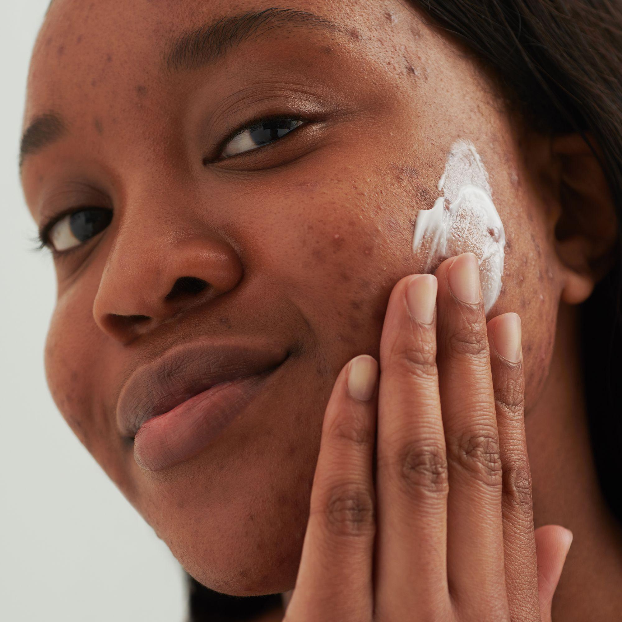 Produktbild DADO SENS PURDERM Waschcreme - bei unreiner Haut 2 von 7