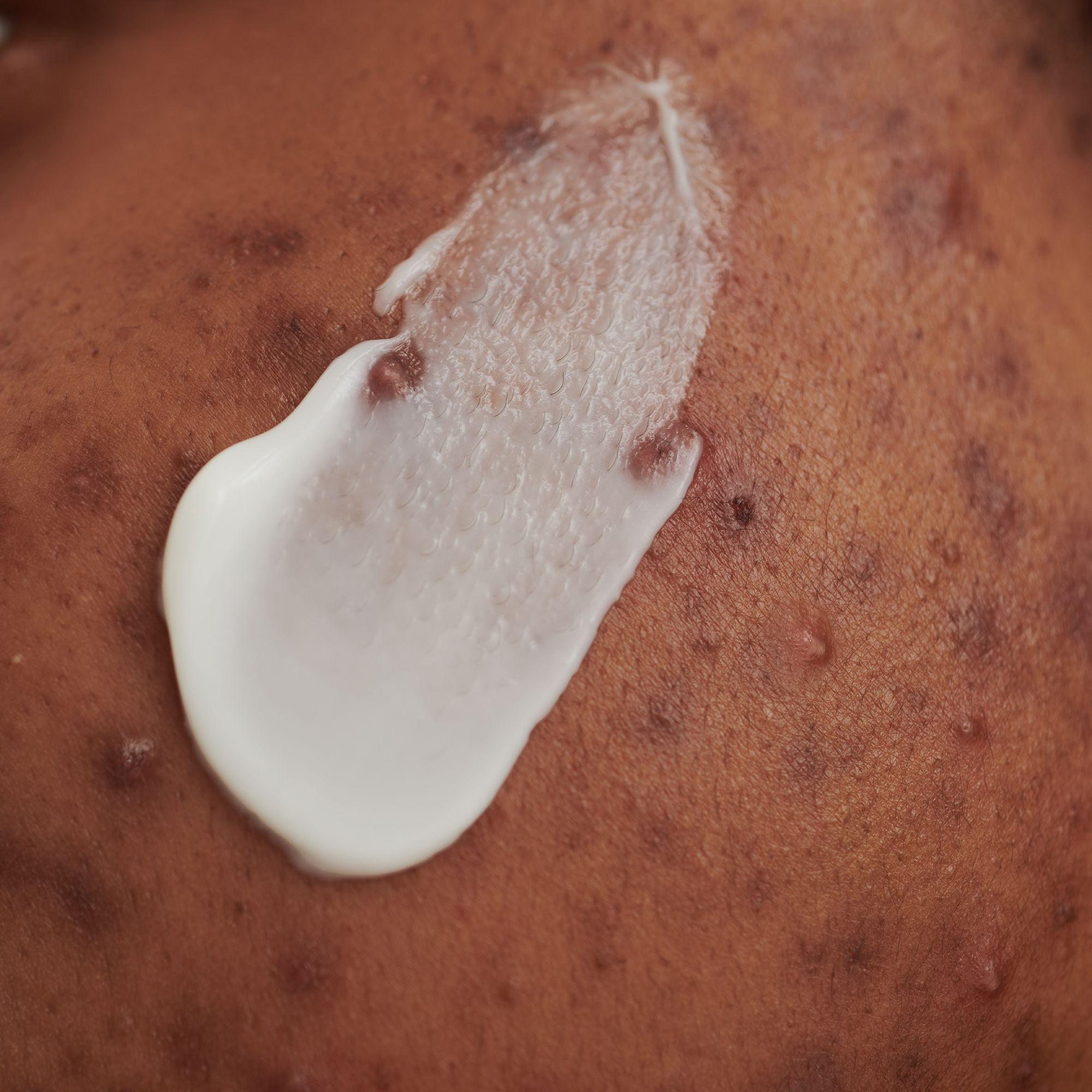 Produktbild DADO SENS PURDERM Waschcreme - bei unreiner Haut 3 von 7