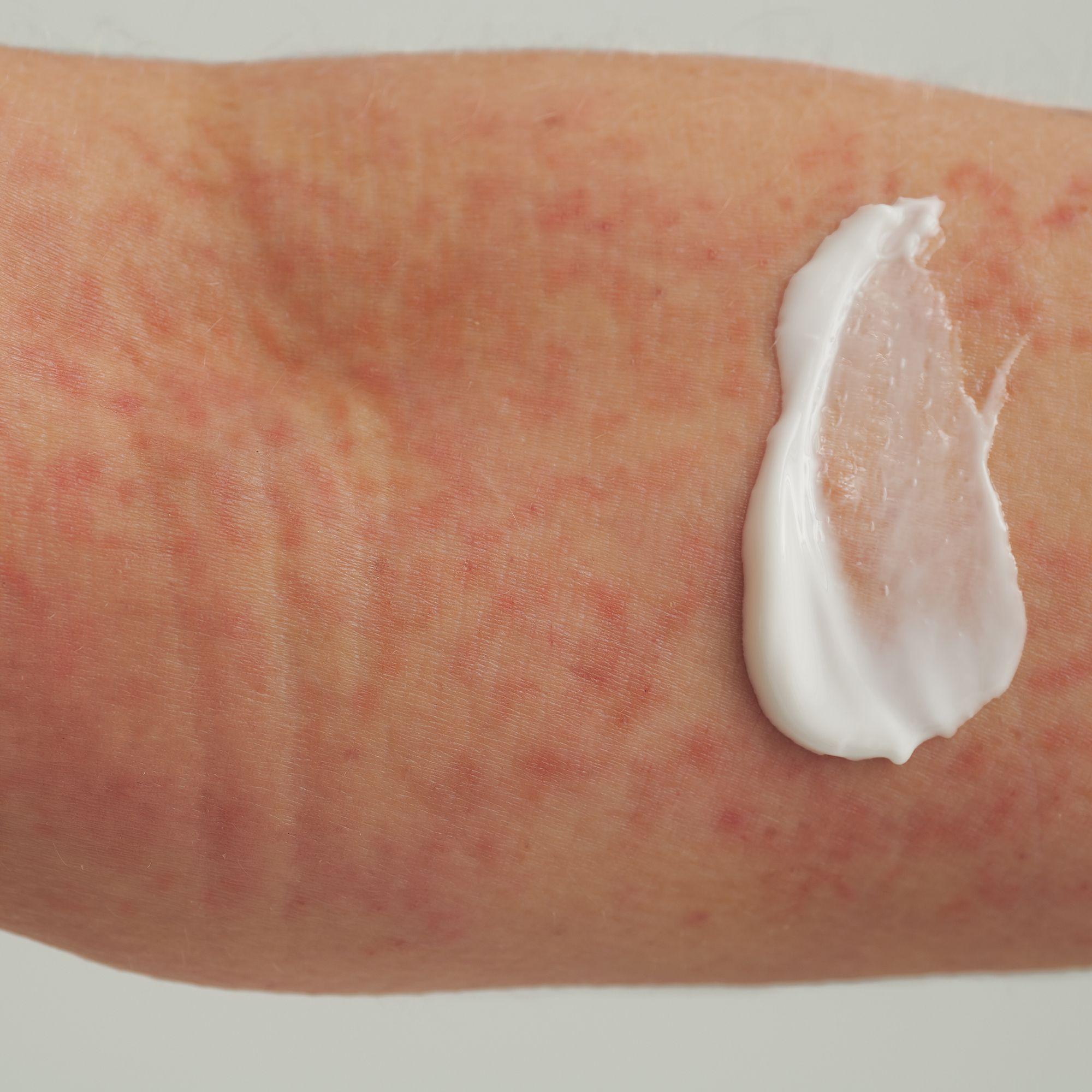 Produktbild DADO SENS EXTRODERM Hautbalsam- bei trockener Haut und Neurodermitis 2 von 8