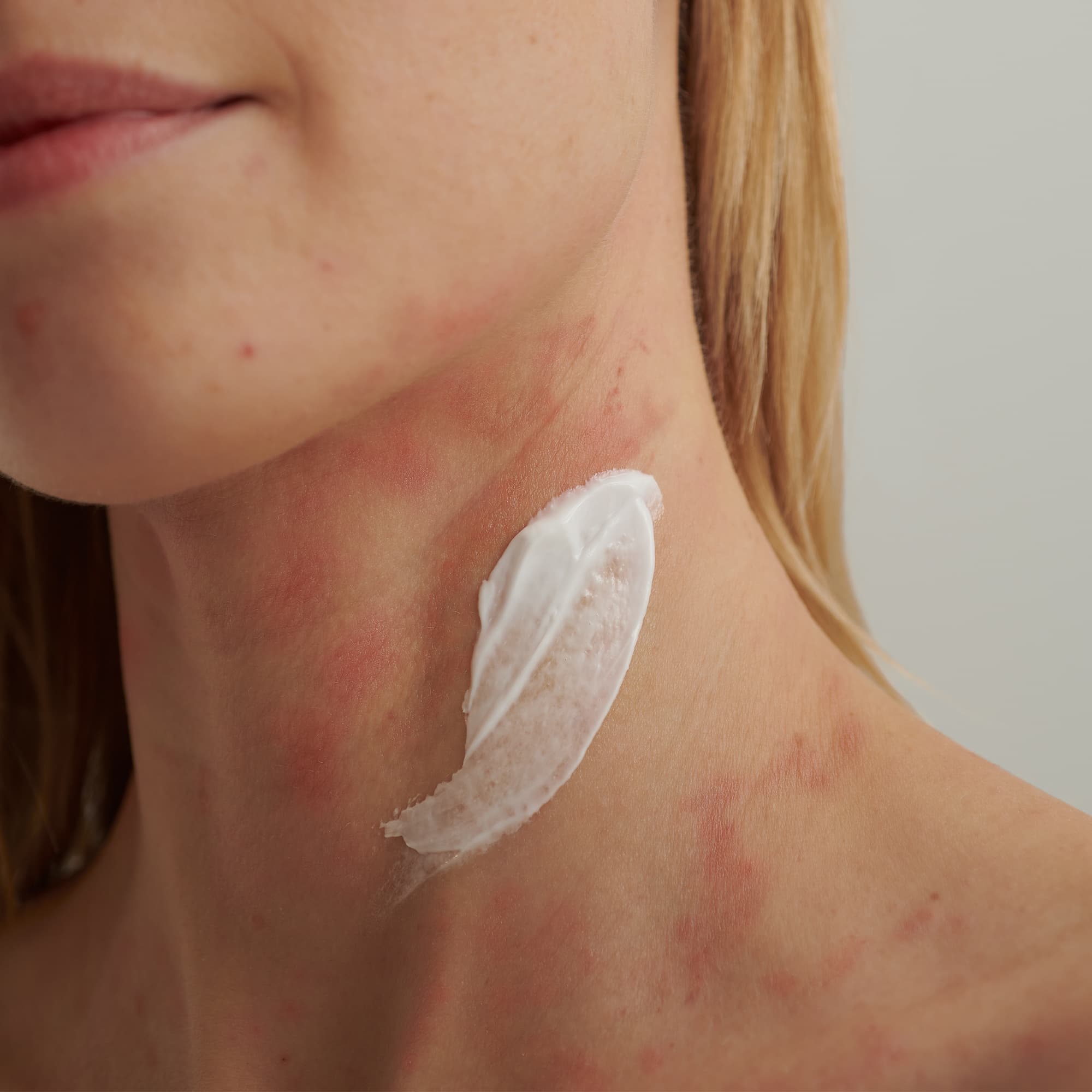 Produktbild DADO SENS EXTRODERM Intensivcreme 4 von 6