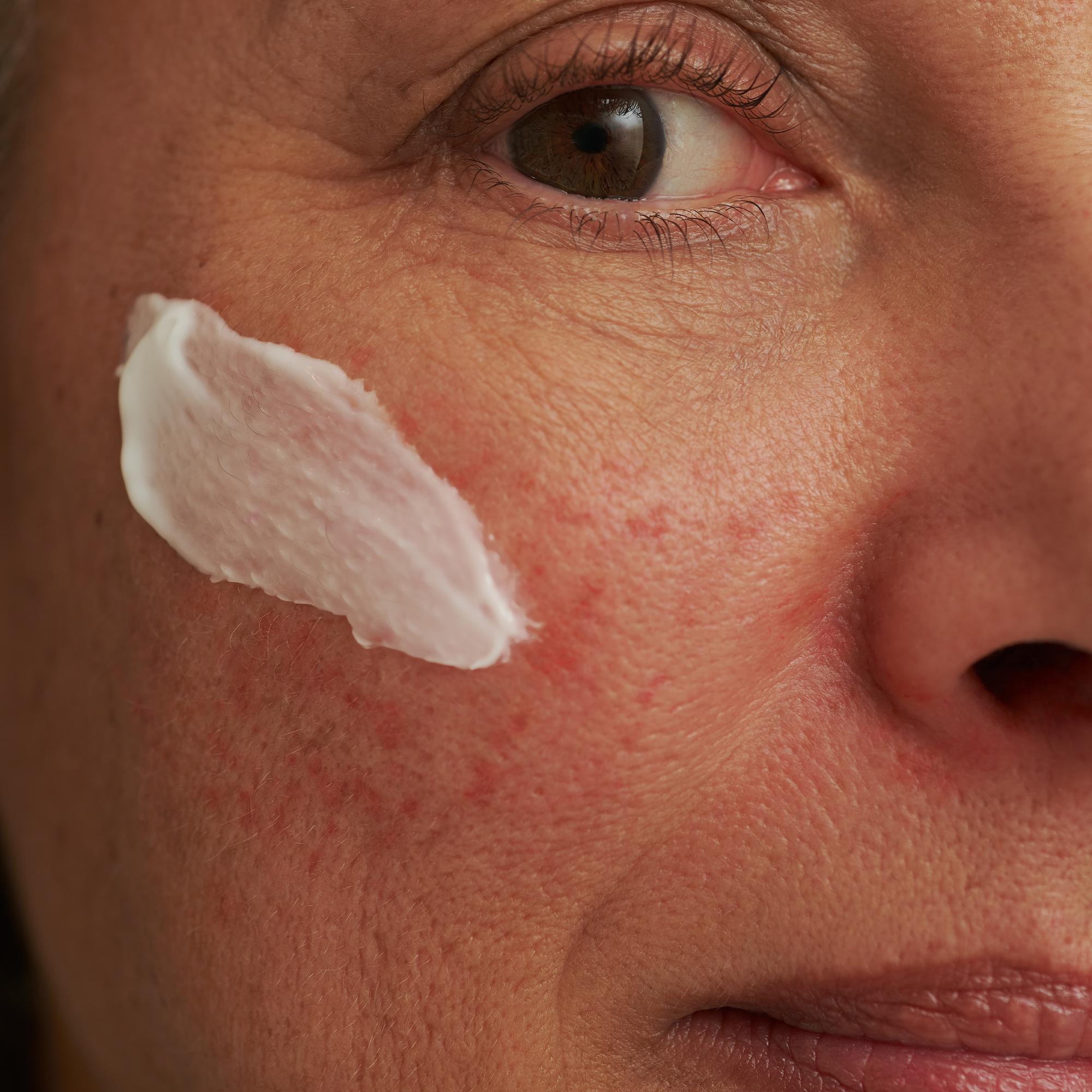 Produktbild DADO SENS SENSACEA Extra Care Gesichtsemulsion 4 von 5