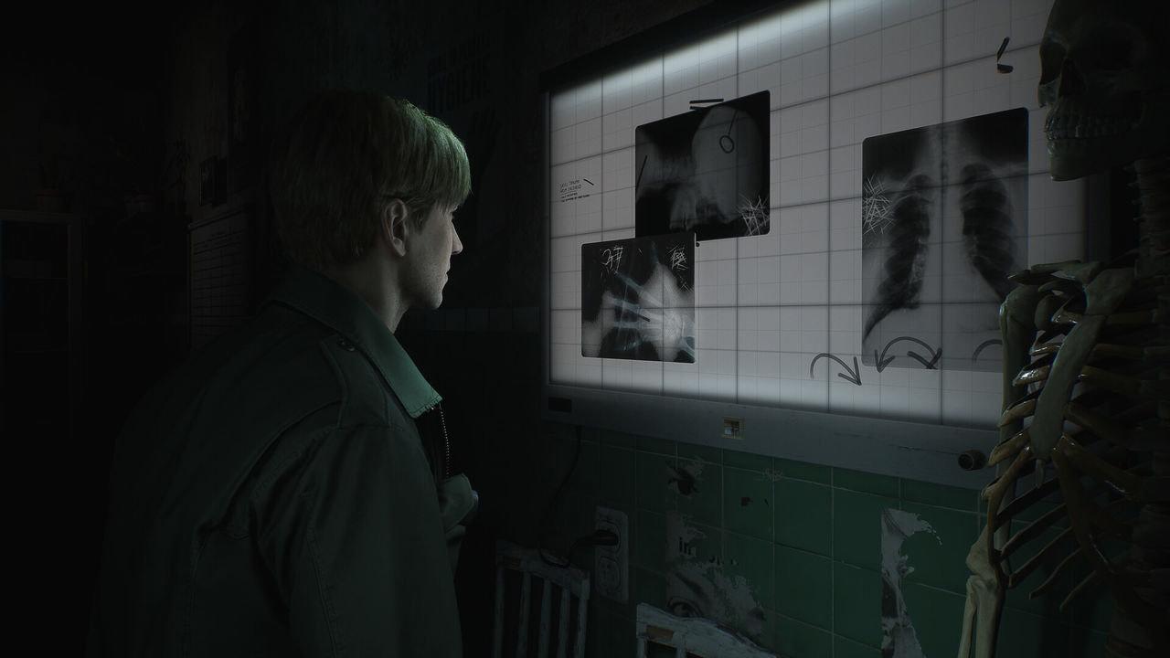 Produktbild Silent Hill 2 3 von 11