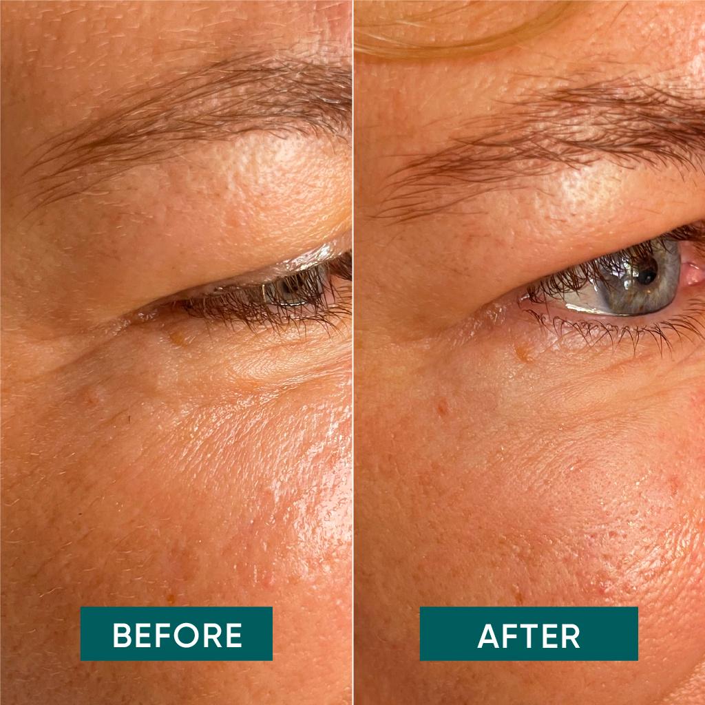 Produktbild APRICOT Augen-Schläfen-Pads Aloe vera 5 von 6