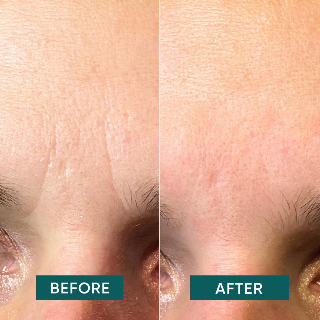 Produktbild APRICOT Baumwoll-Gesichtspflaster mit Niacinamid 2 von 4