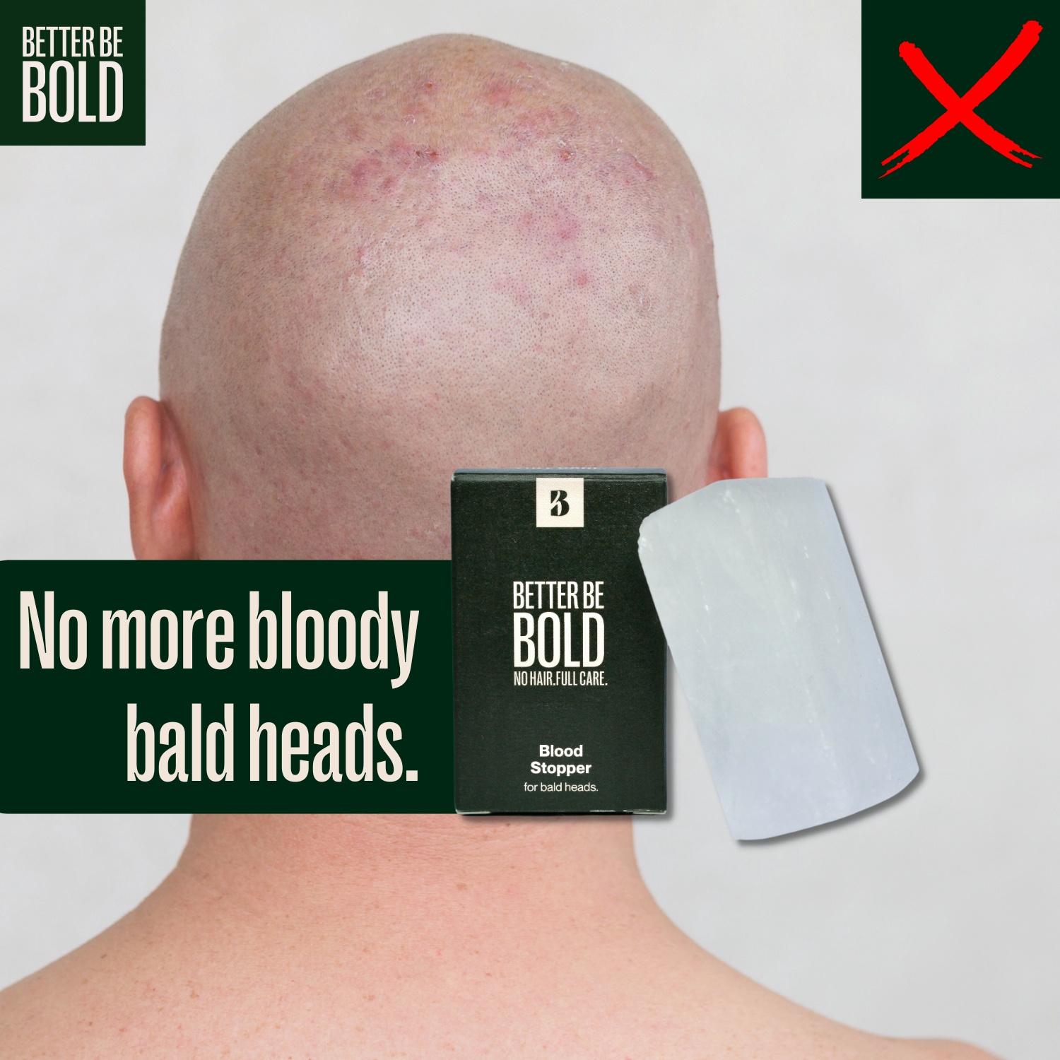 Produktbild BETTER BE BOLD Blood Stopper Alaunstein 3 von 6