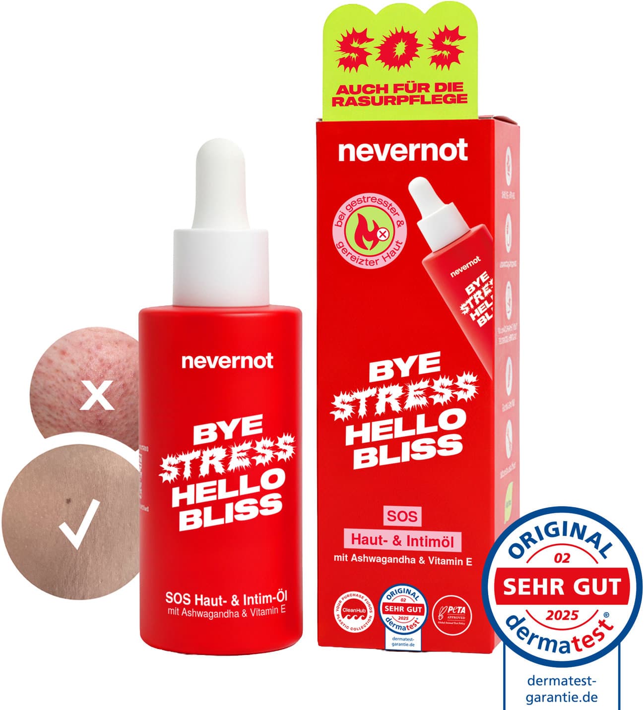 nevernot SOS Haut- und Intimöl
