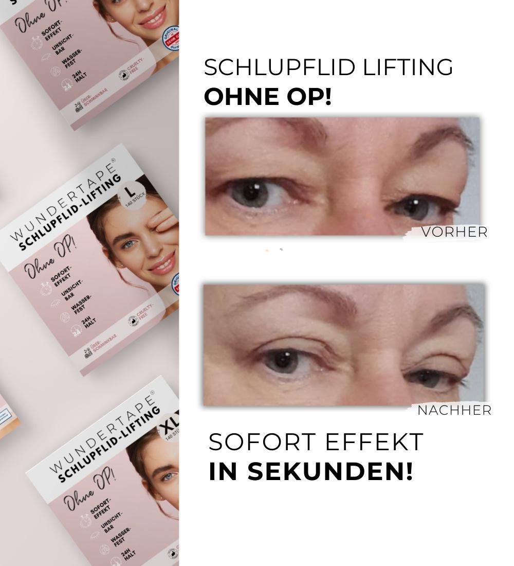 Produktbild WUNDERTAPE Schlupflid Tape Größe M+L+XL 5 von 5