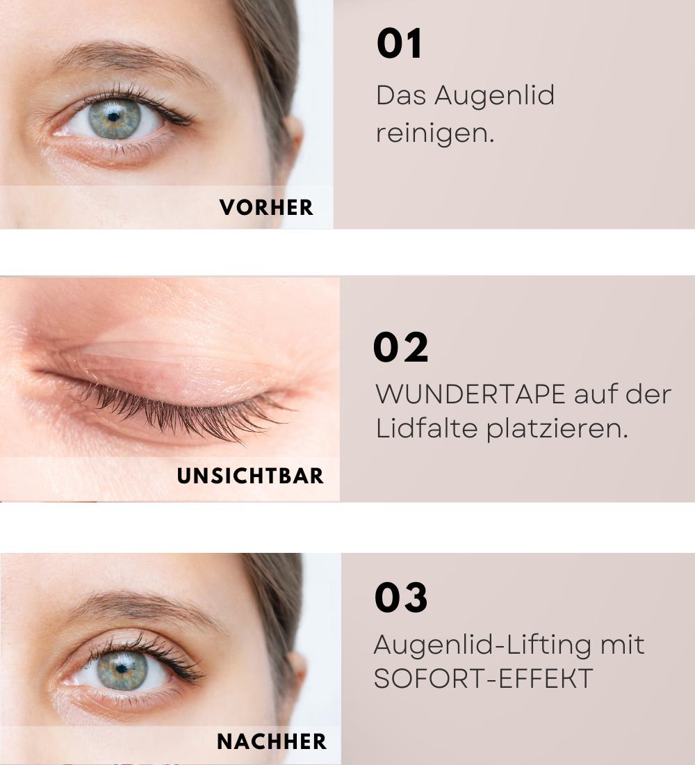 Produktbild WUNDERTAPE Schlupflid Tape Größe M+L+XL 4 von 5