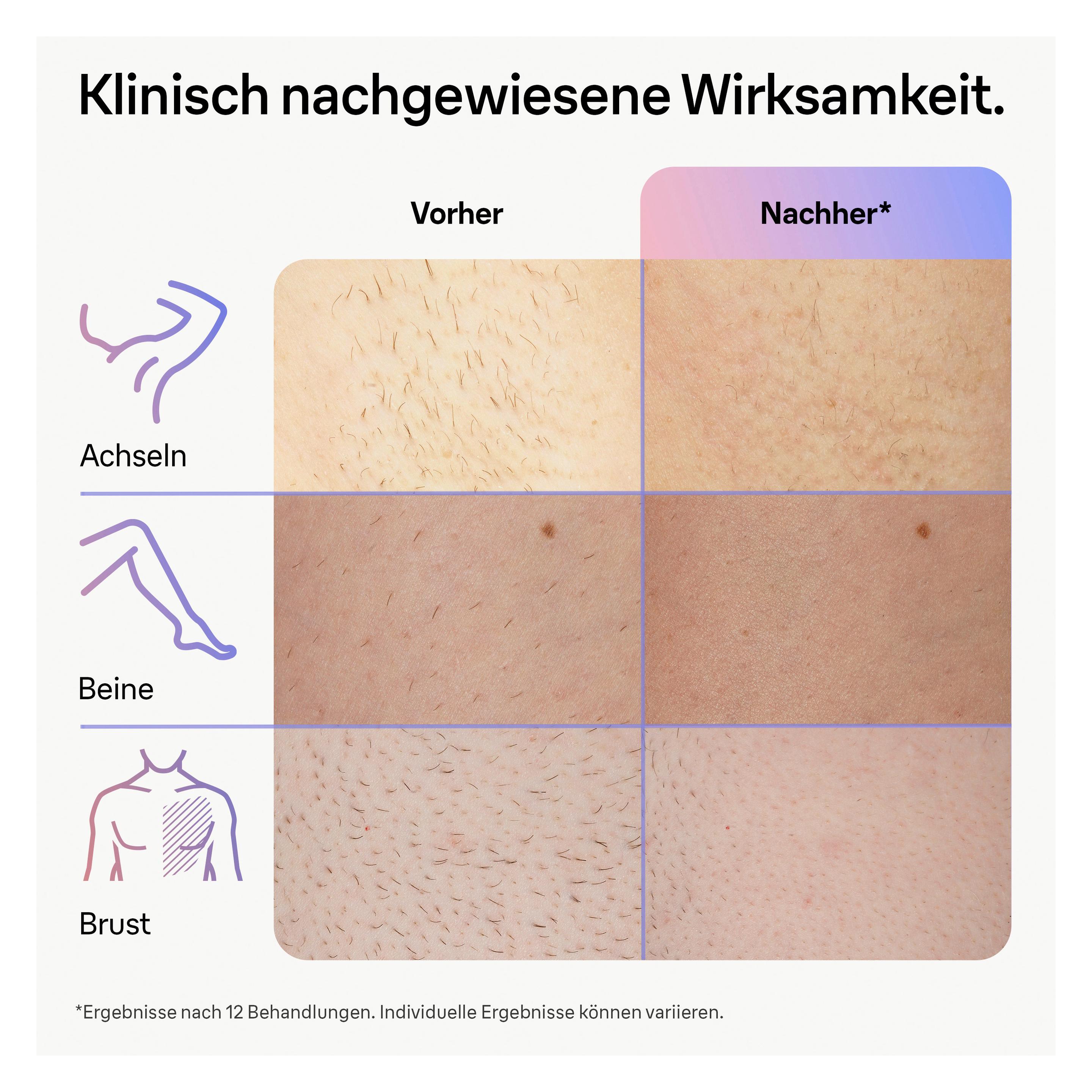 Produktbild BRAUN IPL-Haarentfernungsgerät Skin i·expert PL7147 13 von 19