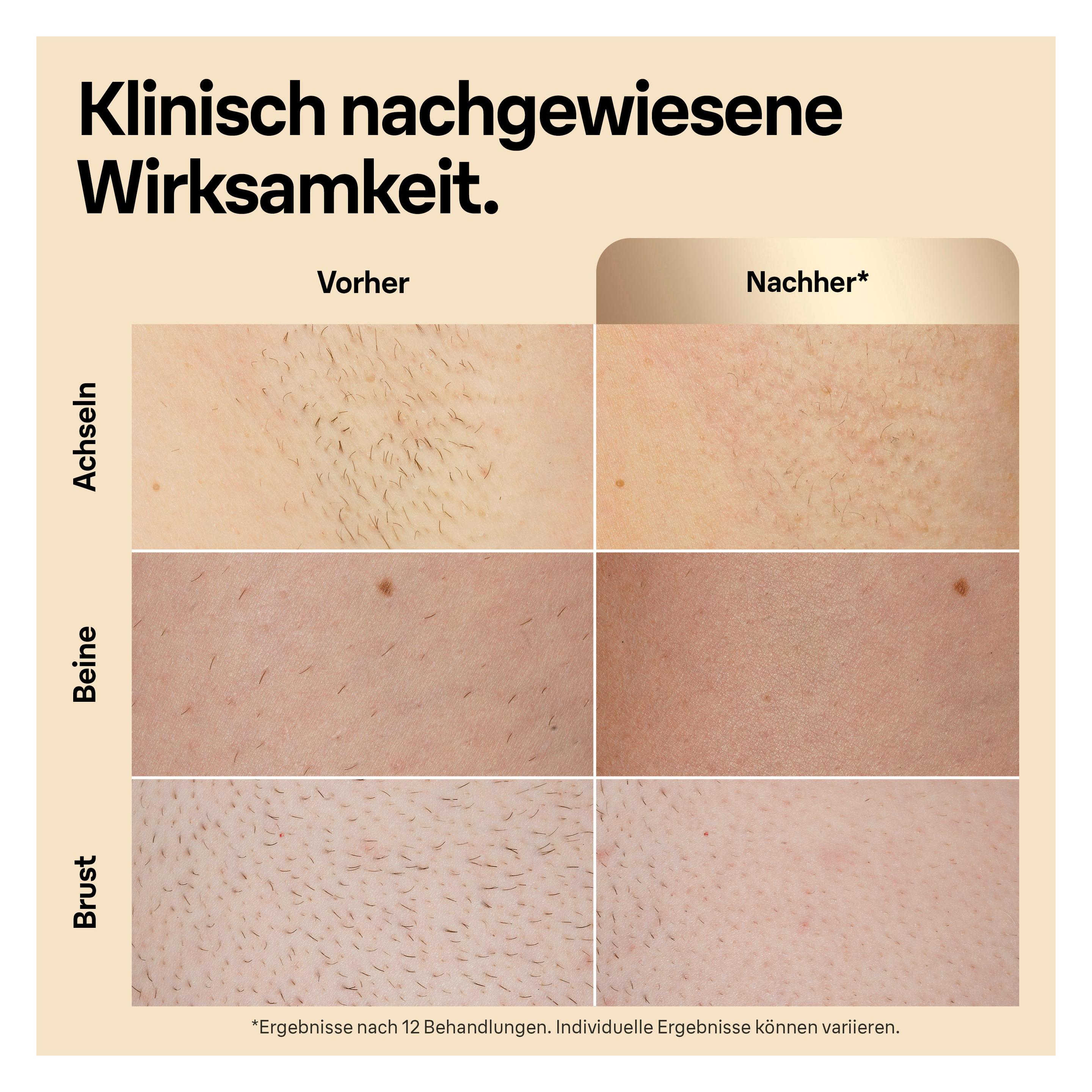 Produktbild BRAUN IPL-Haarentfernungsgerät Silk·expert Pro 5 PL5152 11 von 20