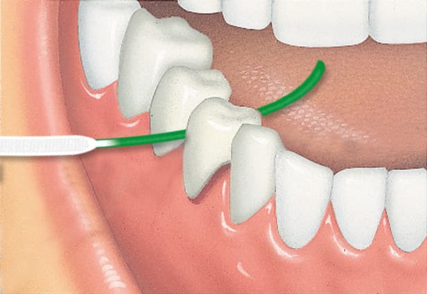 Produktbild GUM® ACCESS FLOSS Zahnseide mit Einfädelhilfe 3 von 4