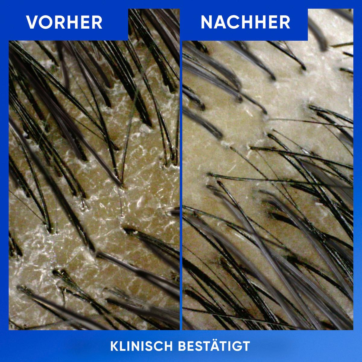 Produktbild Head&Shoulders Anti Schuppen Shampoo Reinigung&Glanz 4 von 7