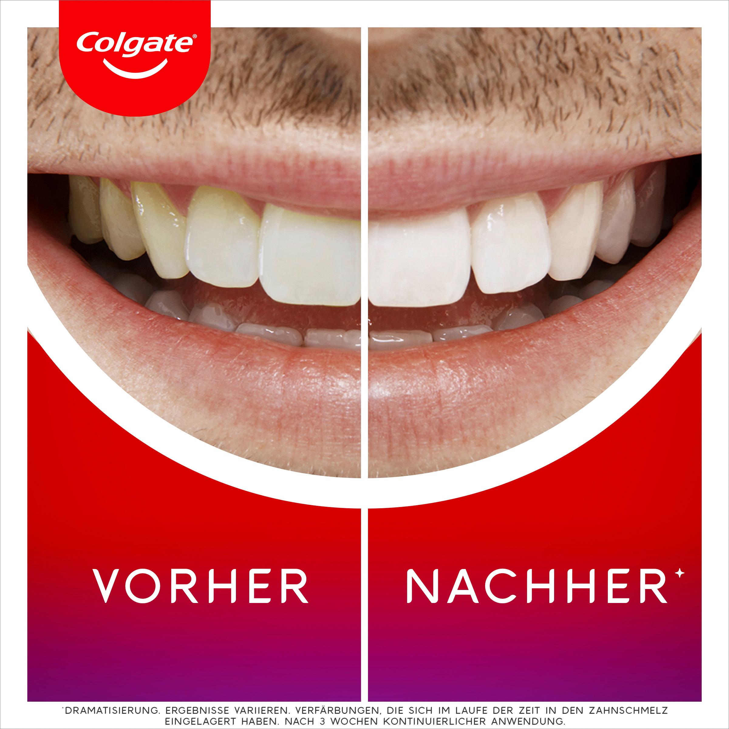Produktbild Colgate Whitening Serum Max White Overnight 7 von 9